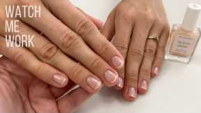 Problem nails with onycholysis  Gentle Manicure with Manucurist Active Shine