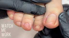 Wellness Pedicure: Detailing deep side walls, gentle dry pedi technique [Watch Me Work]