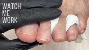 Watch me work and explain dry pedicure.