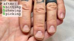 Restarting your nails [after falling off the wagon] WEEK 1