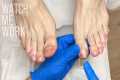 Pedicuring toenails with micro trauma 