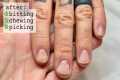 Restarting your nails [after falling