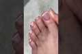 Broken nails + manicure and pedicure