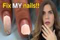 42-Day Old Gel Manicure Rescue