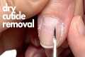 How to remove a cuticle WITHOUT
