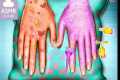 Hand Care and Skin Care Video |